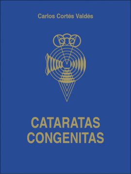 Cataratas congénitas