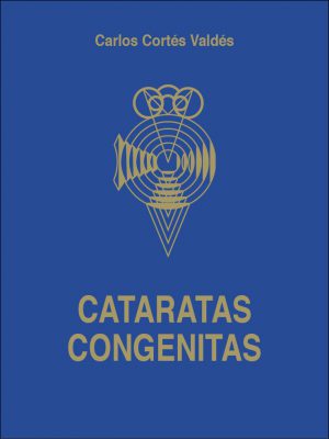 Cataratas congénitas