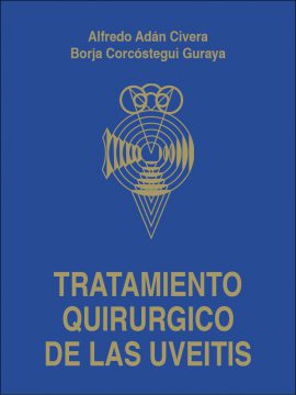 Tratamiento quirúrgico de las uveítis