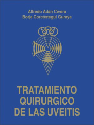 Tratamiento quirúrgico de las uveítis
