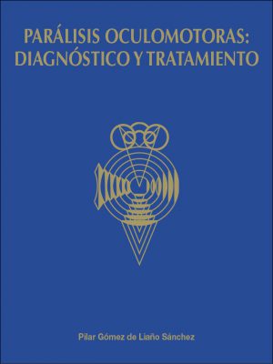 Parálisis oculomotoras: diagnóstico y tratamiento
