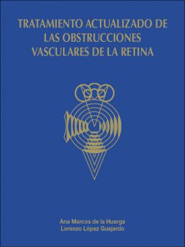 Tratamiento actualizado de las obstrucciones vasculares de la retina