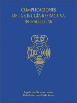 Complicaciones de la cirugía refractiva intraocular