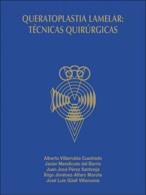 Queratoplastia lamelar: técnicas quirúrgicas