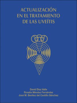 Actualización en el tratamiento de las uveítis
