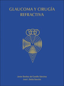 Glaucoma y cirugía refractiva