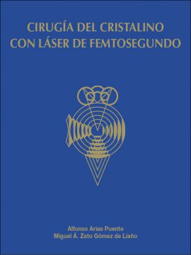 Cirugía del cristalino con láser de femtosegundo