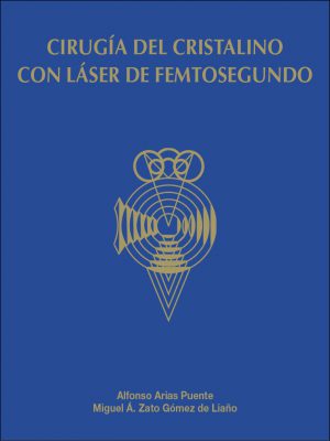 Cirugía del cristalino con láser de femtosegundo