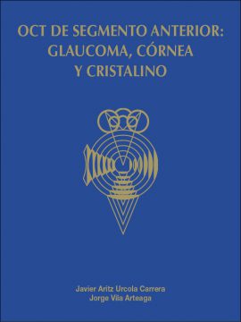 OCT de segmento anterior: glaucoma, córnea y cristalino