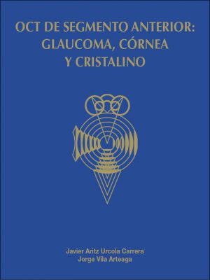 OCT de segmento anterior: glaucoma, córnea y cristalino
