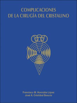 Complicaciones de la cirugía del cristalino