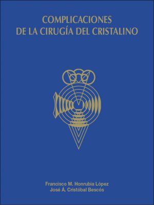 Complicaciones de la cirugía del cristalino