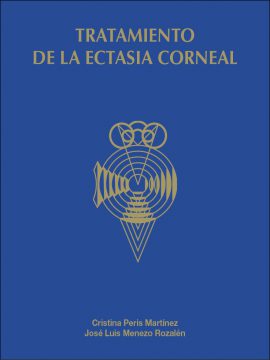 Tratamiento de la ectasia corneal