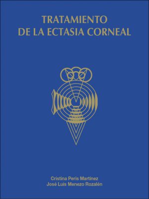 Tratamiento de la ectasia corneal