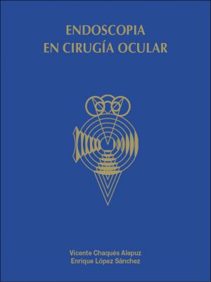 Endoscopia en cirugía ocular