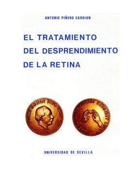 El tratamiento del desprendimiento de la retina