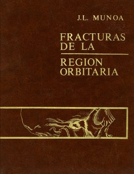Fracturas de la región orbitaria