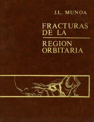 Fracturas de la región orbitaria