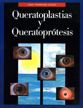 Queratoplastias y queratoprótesis