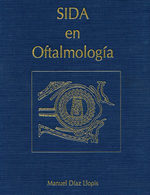 Sida en oftalmología