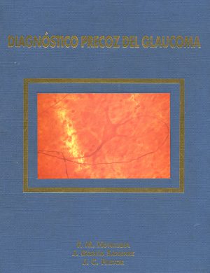 Diagnóstico precoz del glaucoma