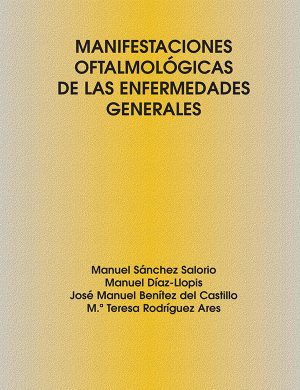 Manifestaciones oftalmológicas de las enfermedades generales