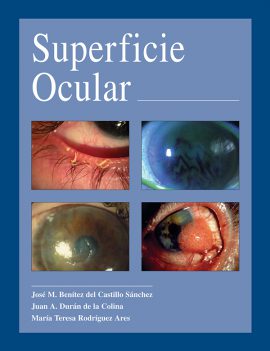 Superficie ocular