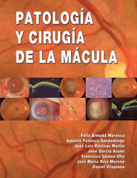 Patología y cirugía de la mácula