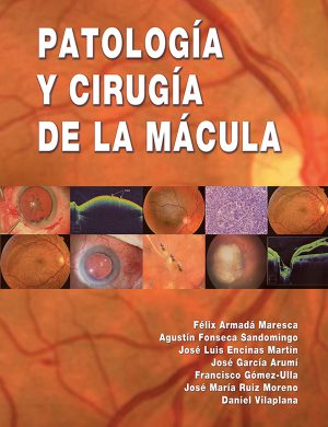 Patología y cirugía de la mácula