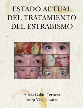 Estado actual del tratamiento del estrabismo (incluye CD)