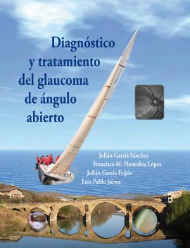 Diagnóstico y tratamiento del glaucoma de ángulo abierto