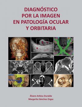 Diagnóstico por la imagen en patología ocular y orbitaria