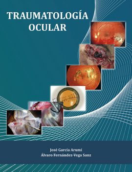 Traumatología ocular