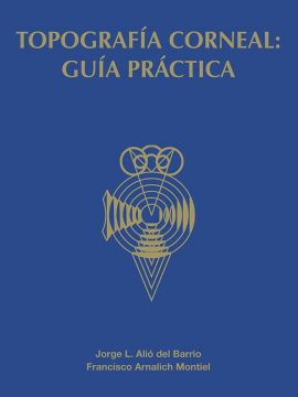 Topografía corneal: guía práctica