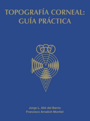 Topografía corneal: guía práctica