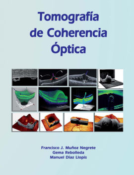 Tomografía de Coherencia Óptica