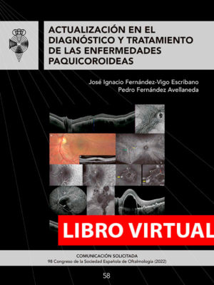 Actualización en el diagnóstico y tratamiento de las enfermedades paquicoroideas (Virtual)