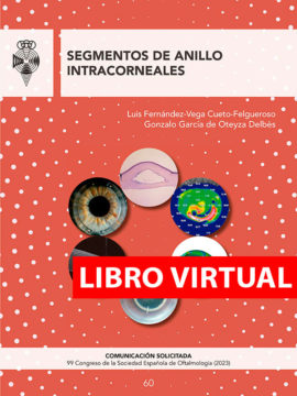 Segmentos de anillo intracorneales (Virtual)
