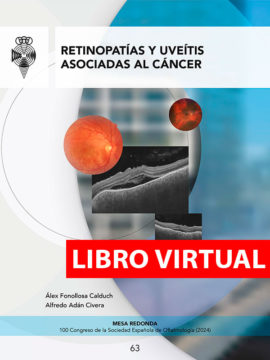 Retinopatías y uveítis asociadas al cáncer (Virtual)
