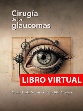 Cirugía de los glaucomas (Virtual)