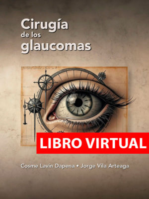Cirugía de los glaucomas (Virtual)