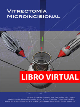 Vitrectomía microincisional (Virtual)